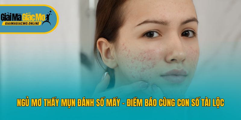 Ngủ Mơ Thấy Mụn Đánh Số Mấy - Điềm Báo Cùng Con Số Tài Lộc