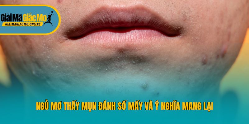 Ngủ mơ thấy mụn đánh số mấy và ý nghĩa mang lại